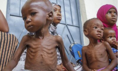 Malnutrition